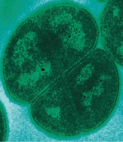 Deinococcus