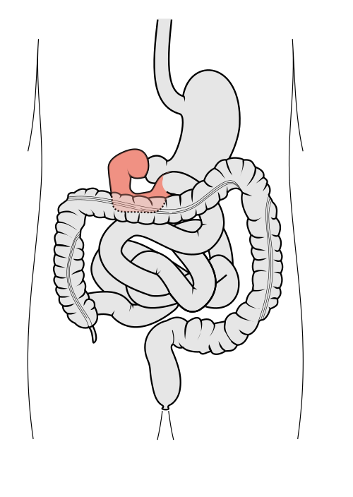 Duodenum